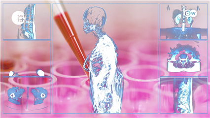 DW's Tomorrow Today: Making cancer cell therapy affordable 