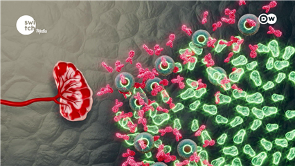 DWs In Good Shape: When the immune system goes rogue